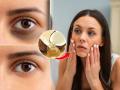Coconut Oil for Dark Circles: Natural Home Remedy That Actually Works - Hindi News | Coconut Oil for Dark Circles: Natural Home Remedy That Actually Works | Latest lifestyle News at Lokmattimes.com
