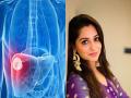 What Is a Liver Tumor? Signs and Symptoms Of Disease Dipika Kakar is Battling - Hindi News | What Is a Liver Tumor? Signs and Symptoms Of Disease Dipika Kakar is Battling | Latest lifestyle News at Lokmattimes.com