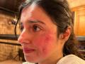 Divya Khosla Kumar badly injured on the sets of her film, shocking pics go viral! - Hindi News | Divya Khosla Kumar badly injured on the sets of her film, shocking pics go viral! | Latest entertainment News at Lokmattimes.com