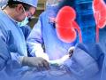 Doctor removes kidney from patient's body instead of stones - Hindi News | Doctor removes kidney from patient's body instead of stones | Latest national News at Lokmattimes.com