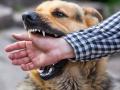 What to Do Immediately After a Dog Bite? Rabies Prevention Tips You Can’t Ignore - Hindi News | What to Do Immediately After a Dog Bite? Rabies Prevention Tips You Can’t Ignore | Latest lifestyle News at Lokmattimes.com