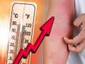 Skin ailments on rise by 30 percent in Mumbai due to scorching heat - Hindi News | Skin ailments on rise by 30 percent in Mumbai due to scorching heat | Latest maharashtra News at Lokmattimes.com