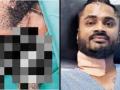 Navi Mumbai: Man rides to hospital with knife pierced into his neck after stabbed by brother - Hindi News | Navi Mumbai: Man rides to hospital with knife pierced into his neck after stabbed by brother | Latest maharashtra News at Lokmattimes.com