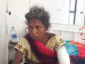 Woman fights off two wild bears to save her husband - Hindi News | Woman fights off two wild bears to save her husband | Latest national News at Lokmattimes.com