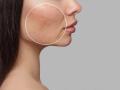Acne Scars on Face: Why They Occur and How to Reduce Them Naturally - Hindi News | Acne Scars on Face: Why They Occur and How to Reduce Them Naturally | Latest lifestyle News at Lokmattimes.com