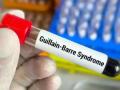 GBS Outbreak in Pune: 138 Water Sources Found Contaminated Amid Guillain-Barré Syndrome Cases - Hindi News | GBS Outbreak in Pune: 138 Water Sources Found Contaminated Amid Guillain-Barré Syndrome Cases | Latest pune News at Lokmattimes.com