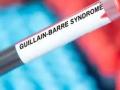 GBS Outbreak: Lack of Chlorine in Drinking Water Linked to Pune Guillain-Barre Syndrome Cases - Hindi News | GBS Outbreak: Lack of Chlorine in Drinking Water Linked to Pune Guillain-Barre Syndrome Cases | Latest pune News at Lokmattimes.com