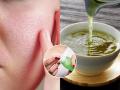 Green Tea Beauty Hack: How to Use It on Your Face for Smooth, Pore-Free Skin - Hindi News | Green Tea Beauty Hack: How to Use It on Your Face for Smooth, Pore-Free Skin | Latest lifestyle News at Lokmattimes.com
