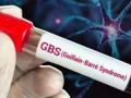 GBS Outbreak in Maharashtra: 56-Year-Old Woman From Pune Dies of Suspected Guillain-Barré Syndrome; 16 New Cases Reported - Hindi News | GBS Outbreak in Maharashtra: 56-Year-Old Woman From Pune Dies of Suspected Guillain-Barré Syndrome; 16 New Cases Reported | Latest maharashtra News at Lokmattimes.com