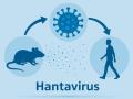 What Is Hantavirus? Symptoms, Causes, Treatment and Prevention - Hindi News | What Is Hantavirus? Symptoms, Causes, Treatment and Prevention | Latest health News at Lokmattimes.com