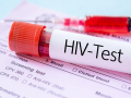 Tripura AIDS Control Society Clarifies Reports on HIV-Positive Students and Deaths - Hindi News | Tripura AIDS Control Society Clarifies Reports on HIV-Positive Students and Deaths | Latest national News at Lokmattimes.com