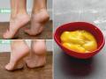 Beauty Tips: Home Remedies For Cracked and Dry Heels - Hindi News | Beauty Tips: Home Remedies For Cracked and Dry Heels | Latest lifestyle News at Lokmattimes.com