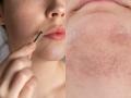 How To Reduce Facial Hair Growth? Know Natural Remedies and Dietary Changes - Hindi News | How To Reduce Facial Hair Growth? Know Natural Remedies and Dietary Changes | Latest lifestyle News at Lokmattimes.com