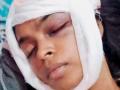 Navi Mumbai: Woman Seriously Injured After Fight With Neighbor Over Dog Poop - Hindi News | Navi Mumbai: Woman Seriously Injured After Fight With Neighbor Over Dog Poop | Latest navi-mumbai News at Lokmattimes.com