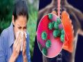 Influenza-A Cases Surge in Maharashtra: 2,325 Infections, 57 Deaths; Mumbai Reports Highest Cases - Hindi News | Influenza-A Cases Surge in Maharashtra: 2,325 Infections, 57 Deaths; Mumbai Reports Highest Cases | Latest mumbai News at Lokmattimes.com