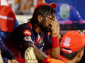 IPL 2026: Krunal Pandya Shares Brutal Injury Photo After Heroics in RCB’s Win Over MI - Hindi News | IPL 2026: Krunal Pandya Shares Brutal Injury Photo After Heroics in RCB’s Win Over MI | Latest cricket News at Lokmattimes.com