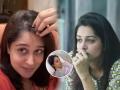 Dipika Kakar Opens Up on Stage 2 Liver Cancer Treatment, Says Hair Loss Has Left Her Upset - Hindi News | Dipika Kakar Opens Up on Stage 2 Liver Cancer Treatment, Says Hair Loss Has Left Her Upset | Latest lifestyle News at Lokmattimes.com