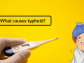 Which Test is Done to Confirm Typhoid Fever? - Hindi News | Which Test is Done to Confirm Typhoid Fever? | Latest health News at Lokmattimes.com
