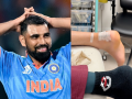 Mohammed Shami Gives Major Update on His Recovery After Heel Surgery - Hindi News | Mohammed Shami Gives Major Update on His Recovery After Heel Surgery | Latest cricket News at Lokmattimes.com