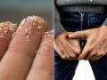 Cancer-Causing Microplastics Found in 100% of Men's Testicles: Study - Hindi News | Cancer-Causing Microplastics Found in 100% of Men's Testicles: Study | Latest health News at Lokmattimes.com