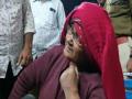Hasina Begum who returned India after being 18 yrs in Pak jail, passes away - Hindi News | Hasina Begum who returned India after being 18 yrs in Pak jail, passes away | Latest aurangabad News at Lokmattimes.com
