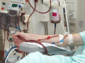 Why Dialysis Is Done Before Kidney Transplant in Some Patients - Hindi News | Why Dialysis Is Done Before Kidney Transplant in Some Patients | Latest health News at Lokmattimes.com