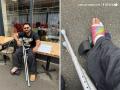 Rishabh Pant Gives BIG Update on His Foot Injury After Being Ruled Out of ENG vs IND 5th Test - Hindi News | Rishabh Pant Gives BIG Update on His Foot Injury After Being Ruled Out of ENG vs IND 5th Test | Latest cricket News at Lokmattimes.com