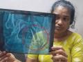 Kerala Shocker: Scissors Found Inside Woman’s Abdomen 5-Years After Surgery, Health Minister Promises Strict Action - Hindi News | Kerala Shocker: Scissors Found Inside Woman’s Abdomen 5-Years After Surgery, Health Minister Promises Strict Action | Latest national News at Lokmattimes.com