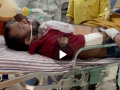 Pune: Youth Sustains Severe Burns After High-Voltage Wire Falls on Him in Ravet - Hindi News | Pune: Youth Sustains Severe Burns After High-Voltage Wire Falls on Him in Ravet | Latest pune News at Lokmattimes.com