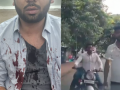 Pune Road Rage: 4 Arrested After Investment Firm Employee Attacked Over Wrong-Side Driving Dispute in Khadki (VIDEO) - Hindi News | Pune Road Rage: 4 Arrested After Investment Firm Employee Attacked Over Wrong-Side Driving Dispute in Khadki (VIDEO) | Latest pune News at Lokmattimes.com
