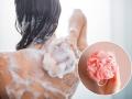 Loofah: Is It Safe for Your Skin? Know the Benefits and Risks - Hindi News | Loofah: Is It Safe for Your Skin? Know the Benefits and Risks | Latest lifestyle News at Lokmattimes.com