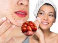 Beauty Tips: Remove Pimples and Dullness Naturally With Tomato and Multani Mitti Ahead of Ganesh Festival - Hindi News | Beauty Tips: Remove Pimples and Dullness Naturally With Tomato and Multani Mitti Ahead of Ganesh Festival | Latest lifestyle News at Lokmattimes.com