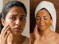 Homemade Face Packs for Oily Skin: Simple Summer Remedies That Work - Hindi News | Homemade Face Packs for Oily Skin: Simple Summer Remedies That Work | Latest lifestyle News at Lokmattimes.com