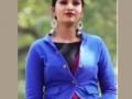 Kannada actress Swathi Sathish's root canal goes horribly wrong, ends up with swollen face - Hindi News | Kannada actress Swathi Sathish's root canal goes horribly wrong, ends up with swollen face | Latest entertainment News at Lokmattimes.com