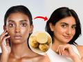 Summer Skincare Tips: Use Potato to Reduce Tan and Get Glowing Skin - Hindi News | Summer Skincare Tips: Use Potato to Reduce Tan and Get Glowing Skin | Latest lifestyle News at Lokmattimes.com