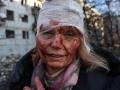 Ukraine Russia Conflict: 7,172 civilian casualties reported in Ukraine since war - Hindi News | Ukraine Russia Conflict: 7,172 civilian casualties reported in Ukraine since war | Latest international News at Lokmattimes.com
