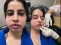 Urfi Javed Shares Lip Filler Removal Video, Internet Reacts to Her Swollen Face - Hindi News | Urfi Javed Shares Lip Filler Removal Video, Internet Reacts to Her Swollen Face | Latest entertainment News at Lokmattimes.com