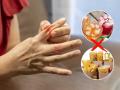 Health Tips: How To Reduce Uric Acid Naturally? What to Eat and What To Avoid - Hindi News | Health Tips: How To Reduce Uric Acid Naturally? What to Eat and What To Avoid | Latest health News at Lokmattimes.com