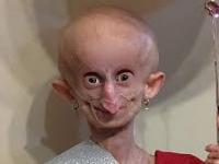 Beandri Booysen Dies at 19: South African TikTok Star Passes Away After Battling With Rare Ageing Disease - News | Beandri Booysen Dies at 19: South African TikTok Star Passes Away After Battling With Rare Ageing Disease | Latest entertainment News at Lokmattimes.com Beandri Booysen Dies at 19: South African TikTok Star Passes Away After Battling With Rare Ageing Disease - News | Beandri Booysen Dies at 19: South African TikTok Star Passes Away After Battling With Rare Ageing Disease | Latest entertainment News at Lokmattimes.com