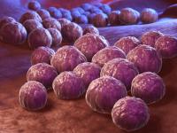 Uncontrollable Spike in Sexually Transmitted Infections Sweeps the United States" - News | Uncontrollable Spike in Sexually Transmitted Infections Sweeps the United States" | Latest health News at Lokmattimes.com Uncontrollable Spike in Sexually Transmitted Infections Sweeps the United States" - News | Uncontrollable Spike in Sexually Transmitted Infections Sweeps the United States" | Latest health News at Lokmattimes.com