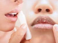 Dry Lips in Winter: Common Mistakes That Make Chapped Lips Worse - News | Dry Lips in Winter: Common Mistakes That Make Chapped Lips Worse | Latest lifestyle News at Lokmattimes.com Dry Lips in Winter: Common Mistakes That Make Chapped Lips Worse - News | Dry Lips in Winter: Common Mistakes That Make Chapped Lips Worse | Latest lifestyle News at Lokmattimes.com