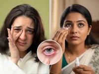 Eye Health Tips: Simple Daily Habits to Keep Your Eyes Healthy and Vision Strong - News | Eye Health Tips: Simple Daily Habits to Keep Your Eyes Healthy and Vision Strong | Latest health News at Lokmattimes.com