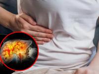 Fatty Liver Symptoms: How to Recognize Early Warning Signs at Home - News | Fatty Liver Symptoms: How to Recognize Early Warning Signs at Home | Latest lifestyle News at Lokmattimes.com