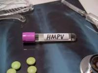 What Is HMPV? Symptoms and How to Stay Safe During Human Metapneumovirus Outbreak - News | What Is HMPV? Symptoms and How to Stay Safe During Human Metapneumovirus Outbreak | Latest national News at Lokmattimes.com What Is HMPV? Symptoms and How to Stay Safe During Human Metapneumovirus Outbreak - News | What Is HMPV? Symptoms and How to Stay Safe During Human Metapneumovirus Outbreak | Latest national News at Lokmattimes.com