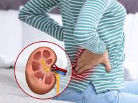 Kidney Disease Symptoms: 5 Early Warning Signs You Should Never Ignore - News | Kidney Disease Symptoms: 5 Early Warning Signs You Should Never Ignore | Latest health News at Lokmattimes.com