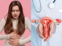 Why Women Living in Cities Face Higher PCOS Risk and How to Prevent It - News | Why Women Living in Cities Face Higher PCOS Risk and How to Prevent It | Latest health News at Lokmattimes.com