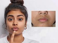 From Sun Tan to Dryness: How to Care for Skin Around Lips This Summer - News | From Sun Tan to Dryness: How to Care for Skin Around Lips This Summer | Latest lifestyle News at Lokmattimes.com