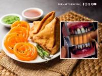 'Samosas, Jalebis Causes...': Nagpur to Be First City to Display Health Warnings on Sugar and Oily Foods, Similar to Tobacco Labels - News | 'Samosas, Jalebis Causes...': Nagpur to Be First City to Display Health Warnings on Sugar and Oily Foods, Similar to Tobacco Labels | Latest nagpur News at Lokmattimes.com