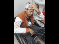 Uttarakhand Horror: Kashmiri Boy Assaulted in Vikas Nagar; One Arrested, Police Assure Action Against Communal Intimidation - News | Uttarakhand Horror: Kashmiri Boy Assaulted in Vikas Nagar; One Arrested, Police Assure Action Against Communal Intimidation | Latest national News at Lokmattimes.com Uttarakhand Horror: Kashmiri Boy Assaulted in Vikas Nagar; One Arrested, Police Assure Action Against Communal Intimidation - News | Uttarakhand Horror: Kashmiri Boy Assaulted in Vikas Nagar; One Arrested, Police Assure Action Against Communal Intimidation | Latest national News at Lokmattimes.com