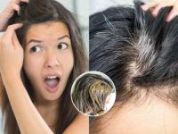 Does Plucking One White Hair Cause More to Grow? Truth, Myths and Natural Remedies - News | Does Plucking One White Hair Cause More to Grow? Truth, Myths and Natural Remedies | Latest lifestyle News at Lokmattimes.com
